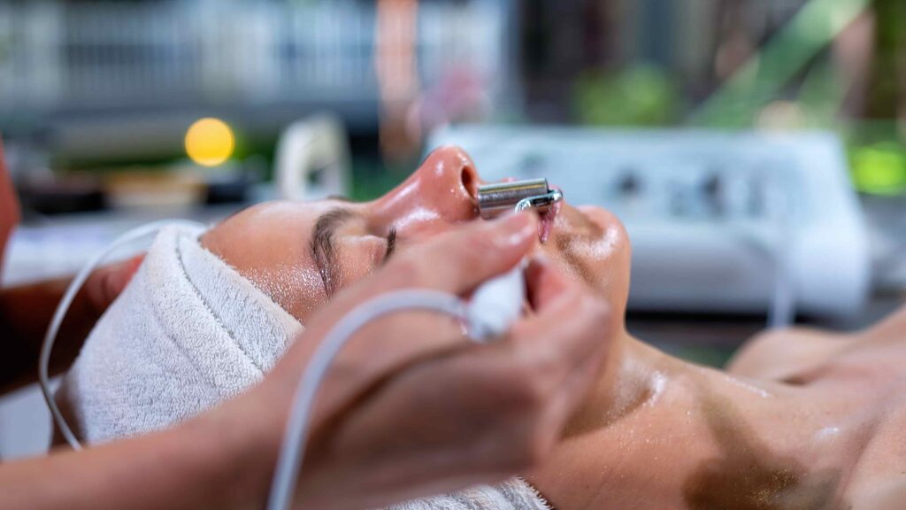 Microdermabrasion Melbourne