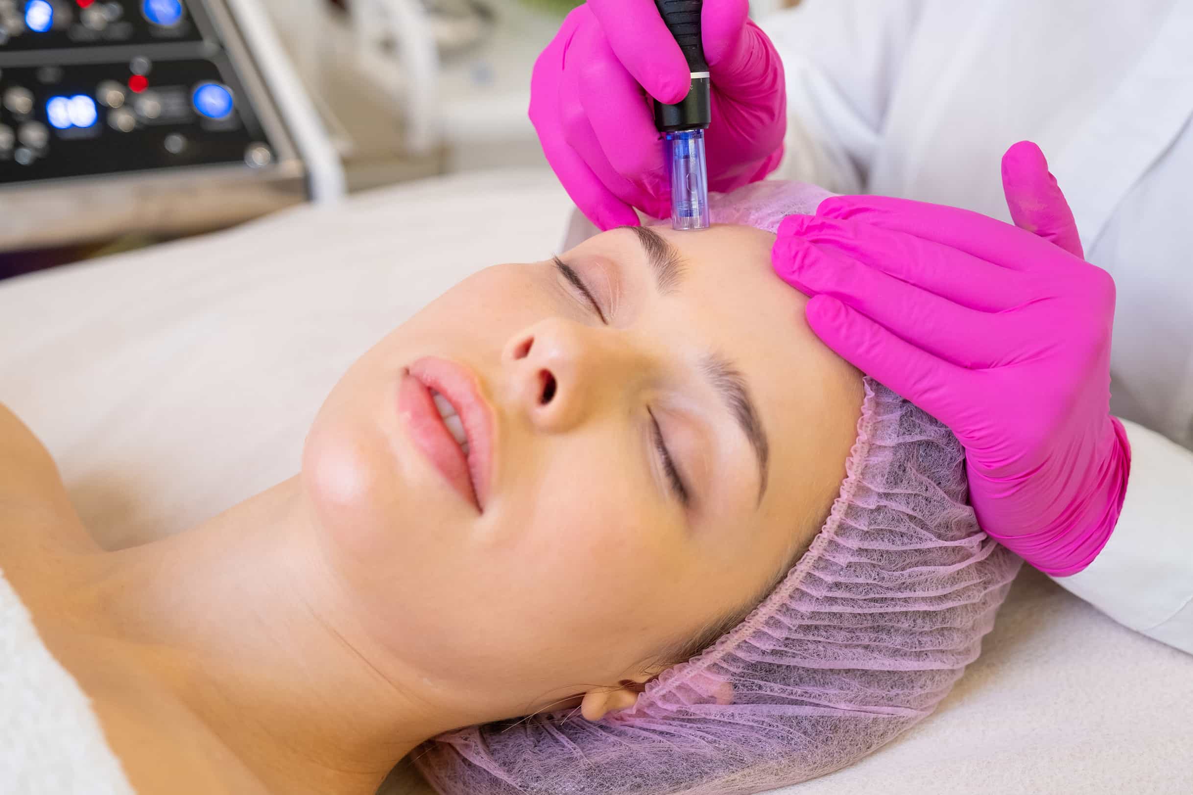Microdermabrasion