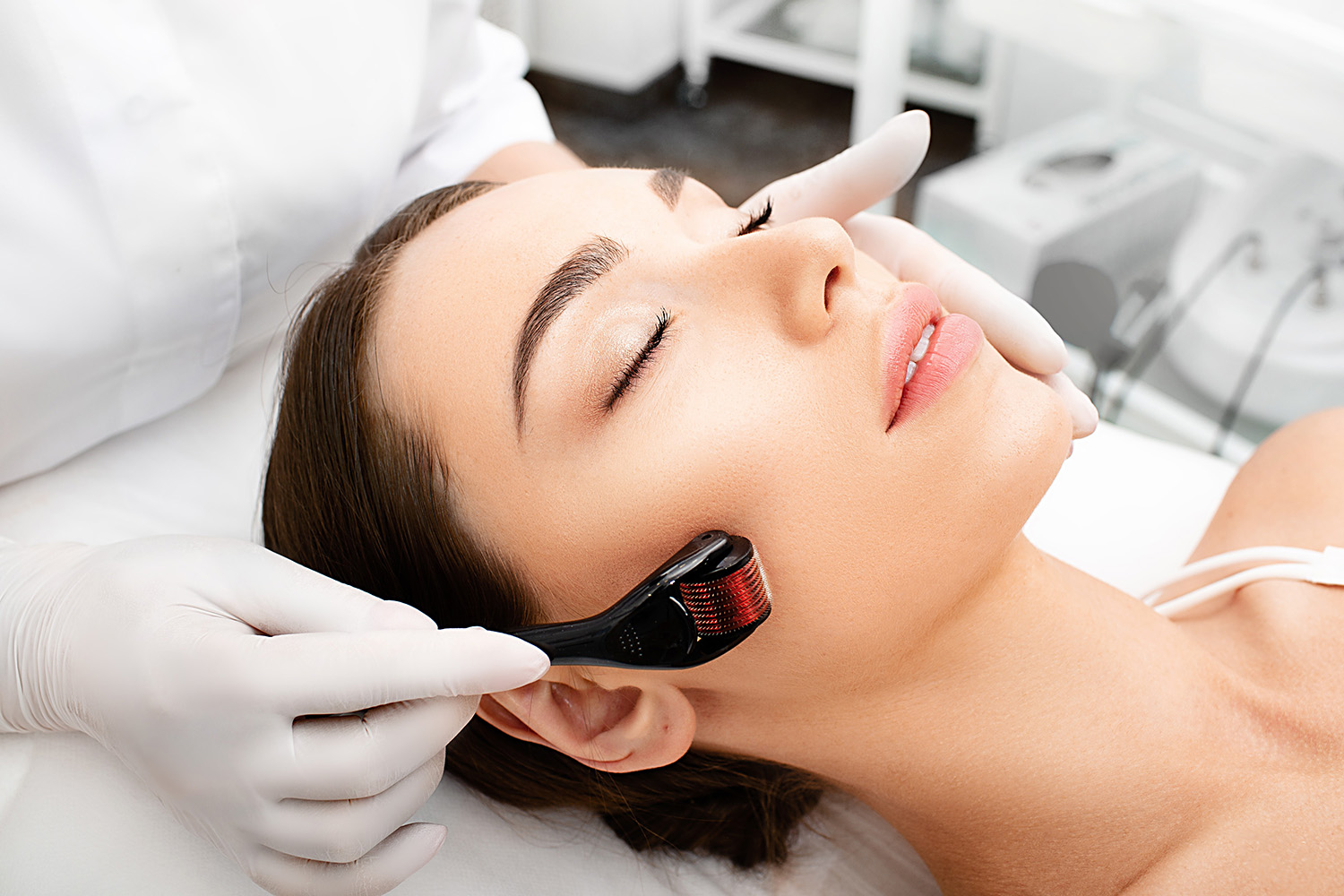 Skin Needling